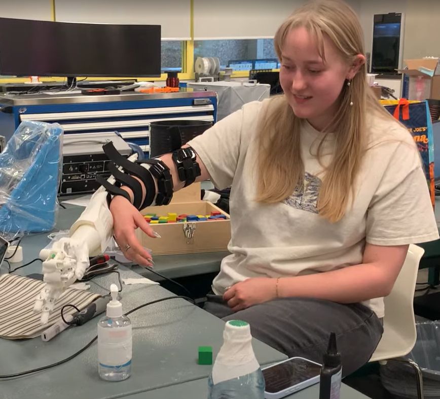 A participant operating a 3D-printed hand on a bypass socket